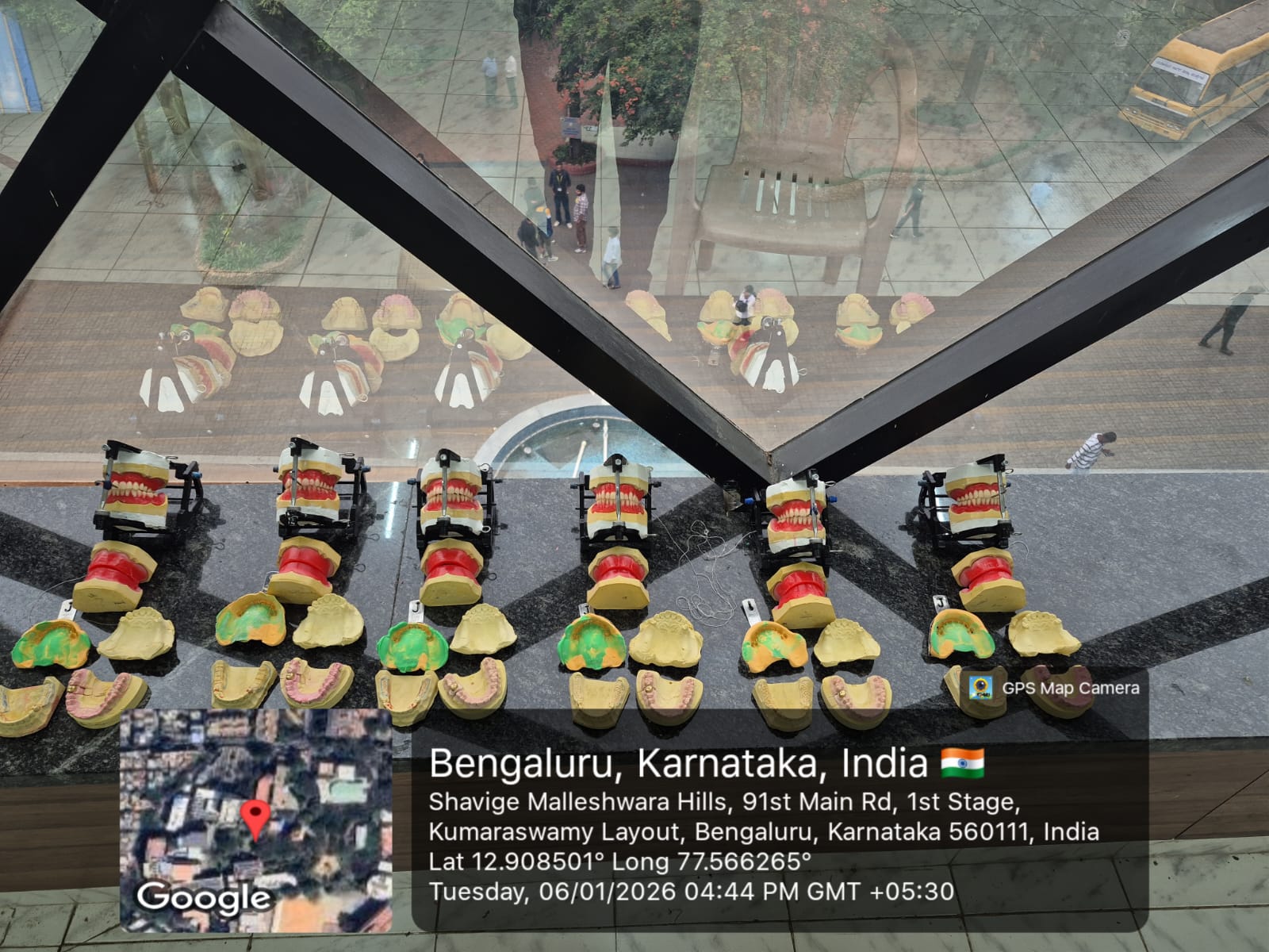 Dental prosthetics models displayed during the Karnataka Skill Olympics competition